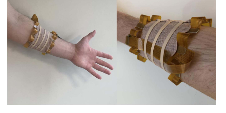 EMaGer worn around a forearm, with a close view of the flexible electrode-array structure.